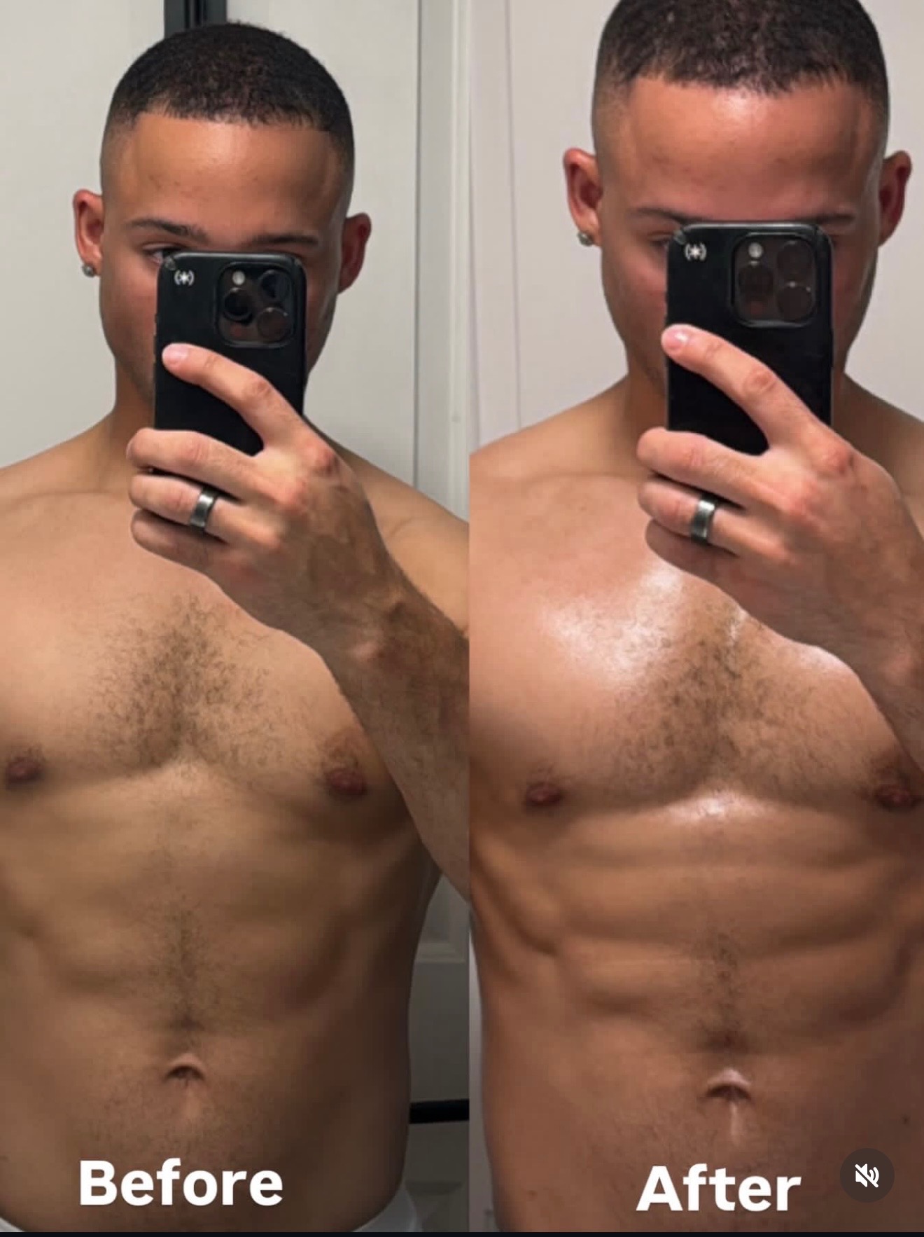 Side-by-side before and after image supplied by ORT for VIP Sculpt™